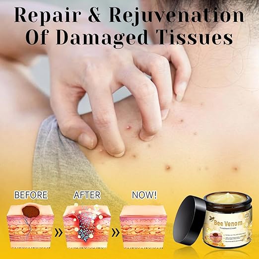 Bee Venom Cream
